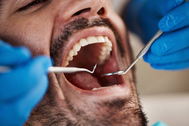 Best Emergency Dental Care for Sports Injuries in Kenmar, PA